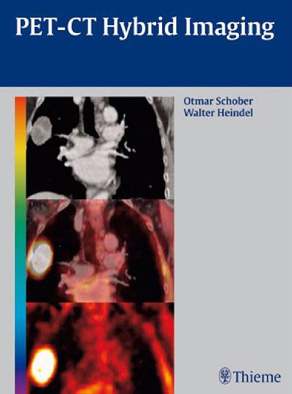 PET-CT Hybrid Imaging 1st Edition â€“ PDF/EPUB Version Downloadable