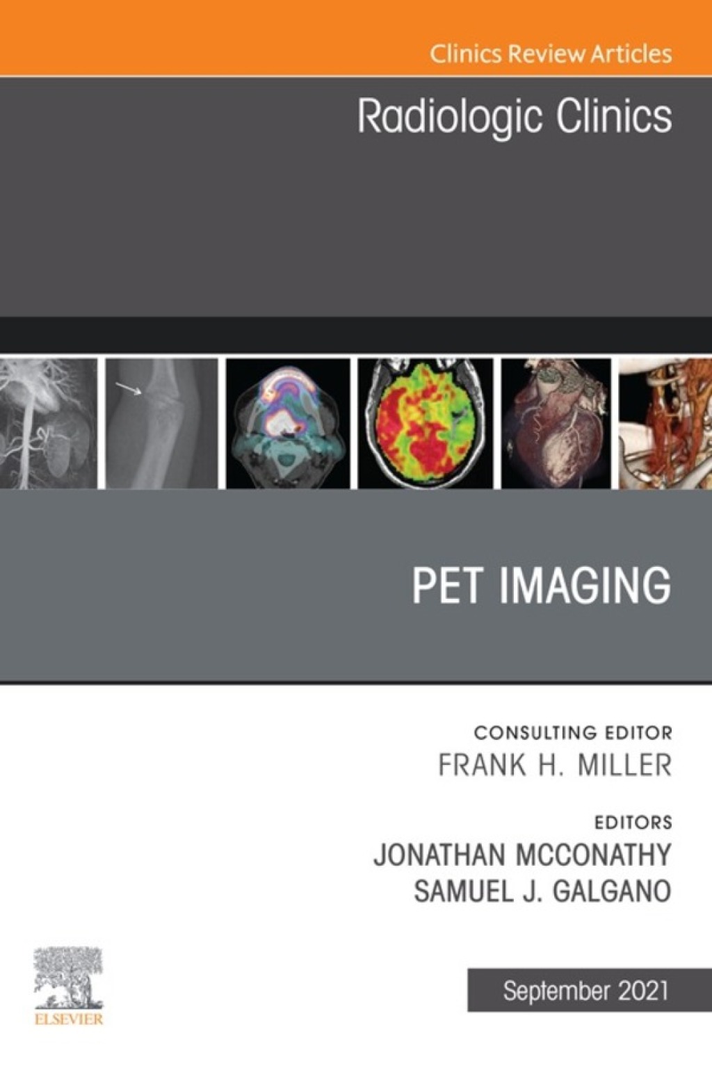 PET Imaging, An Issue of Radiologic Clinics of North America  â€“ PDF/EPUB Version Downloadable
