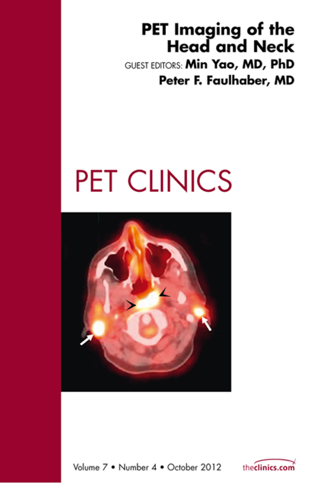 PET Imaging of the Head and Neck, An Issue of PET Clinics  â€“ PDF/EPUB Version Downloadable