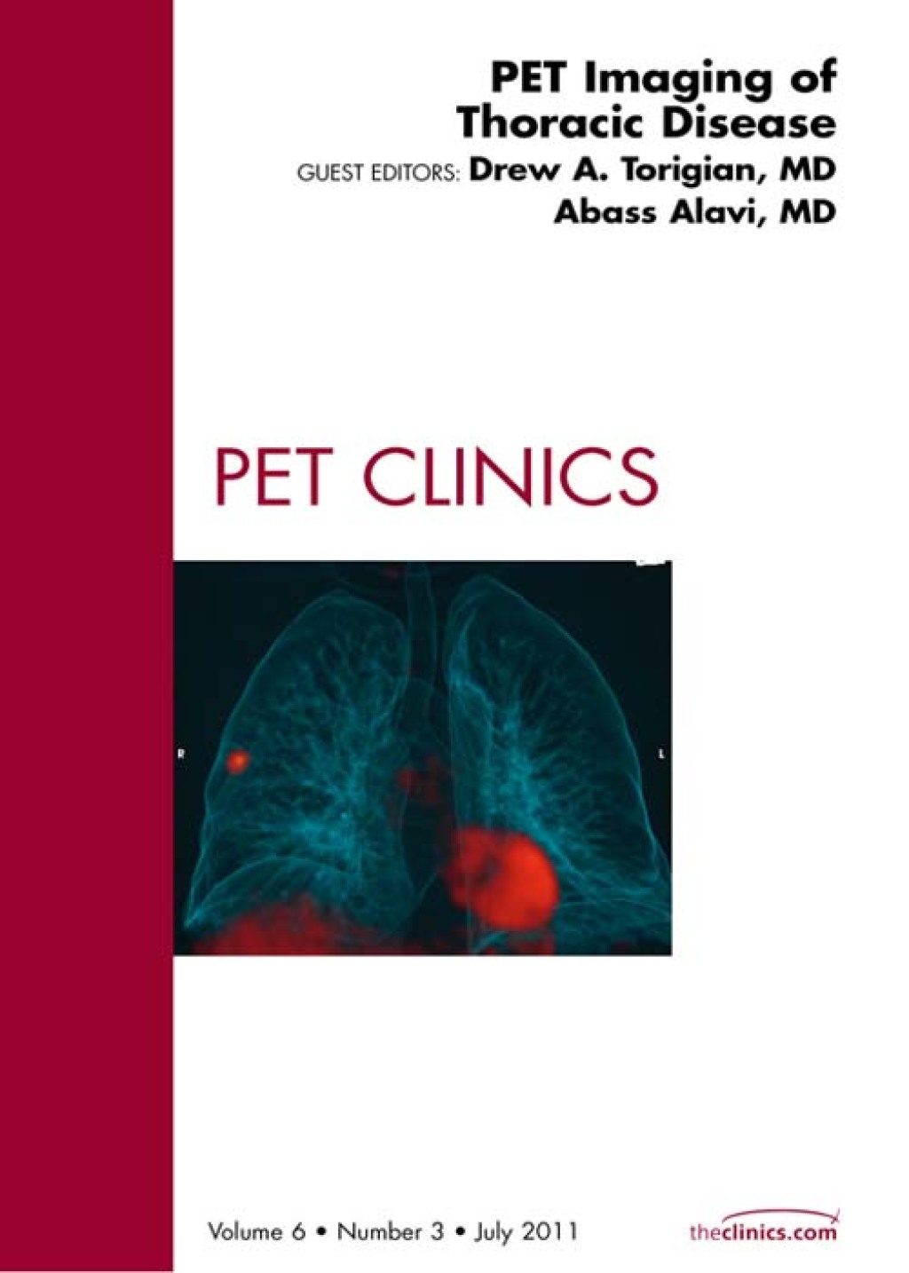 PET Imaging of Thoracic Disease, An Issue of PET Clinics  â€“ PDF/EPUB Version Downloadable