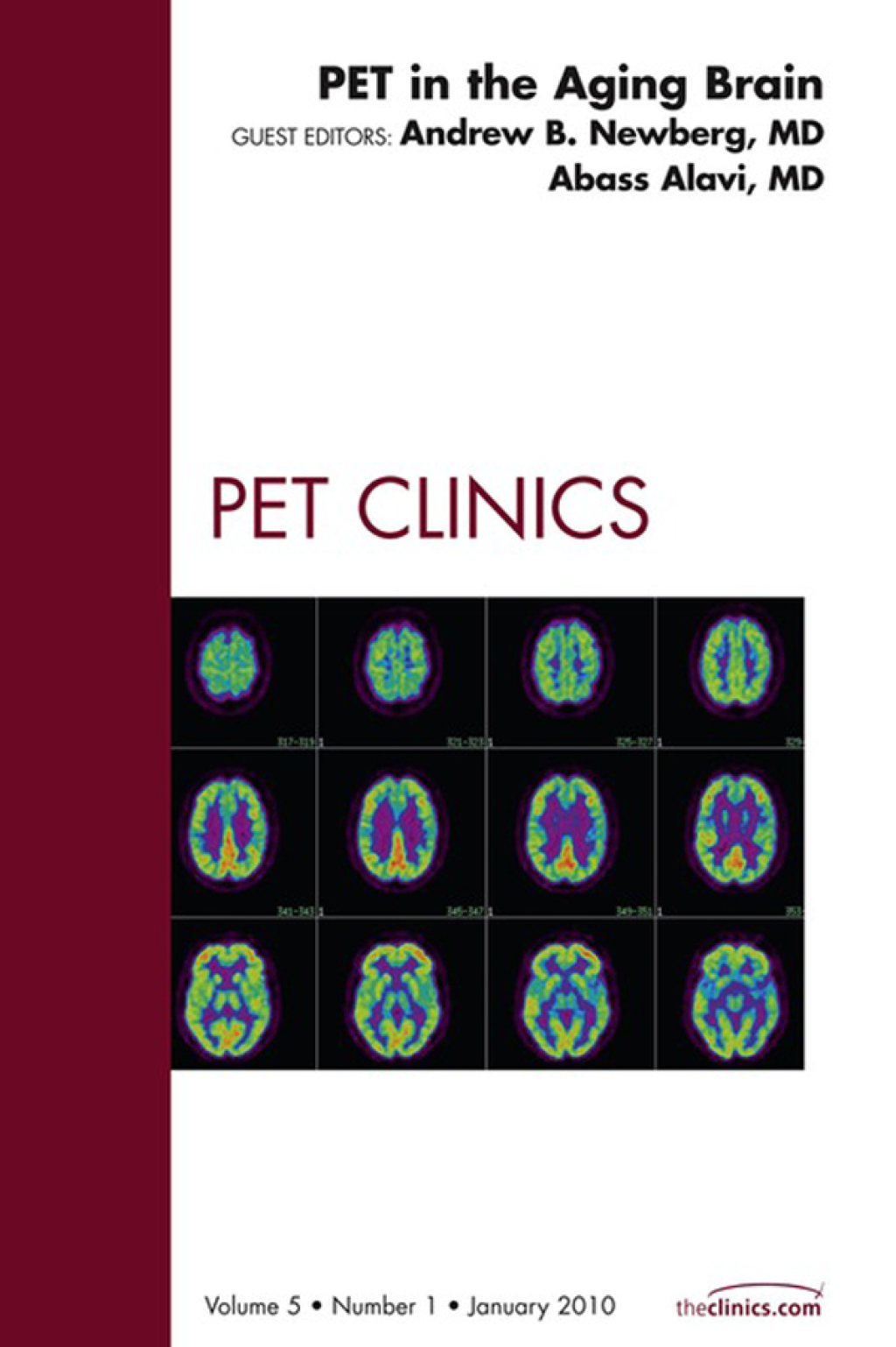 PET in the Aging Brain, An Issue of PET Clinics  â€“ PDF/EPUB Version Downloadable
