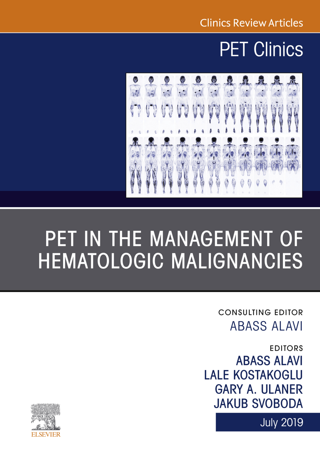 PET in the Management of Hematologic Malignancies, An Issue of PET Clinics  â€“ PDF/EPUB Version Downloadable