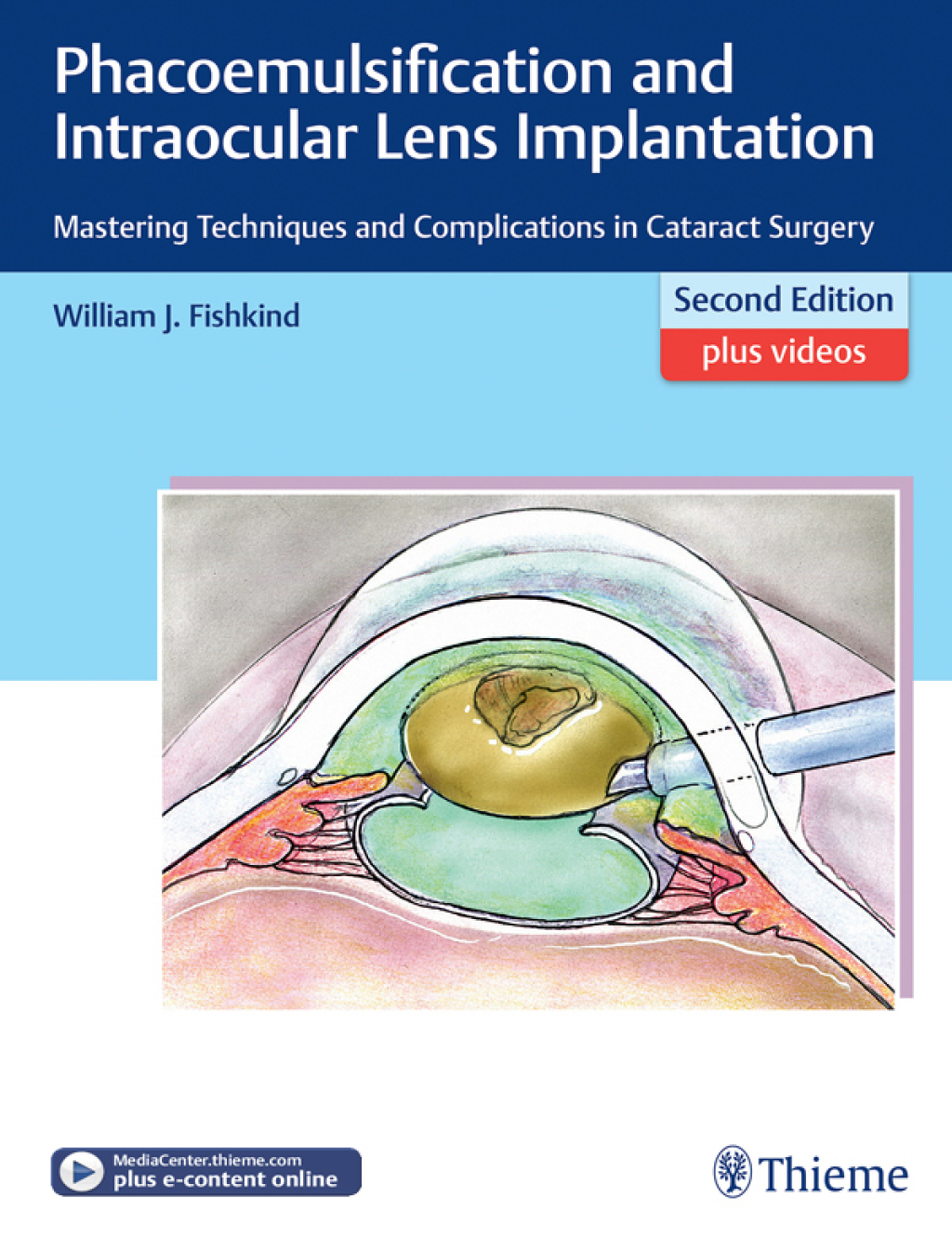 Phacoemulsification and Intraocular Lens Implantation Mastering Techniques and Complications in Cataract Surgery 2nd Edition â€“ PDF/EPUB Version Downloadable