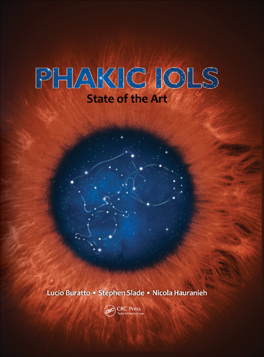 Phakic IOLs State of the Art 1st Edition â€“ PDF/EPUB Version Downloadable