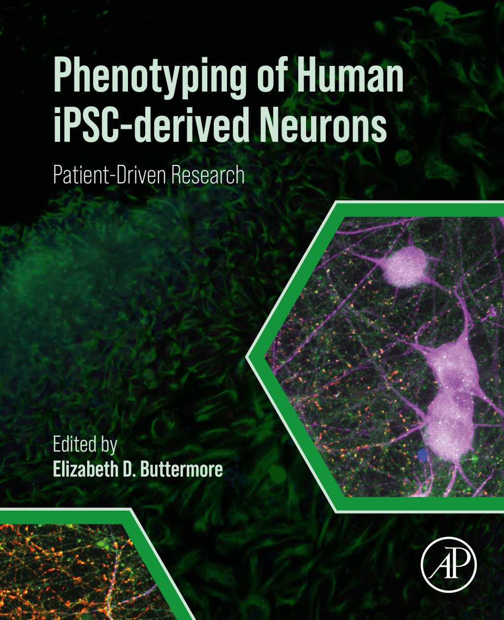 Phenotyping of Human iPSC-derived Neurons Patient-Driven Research 1st Edition â€“ PDF/EPUB Version Downloadable