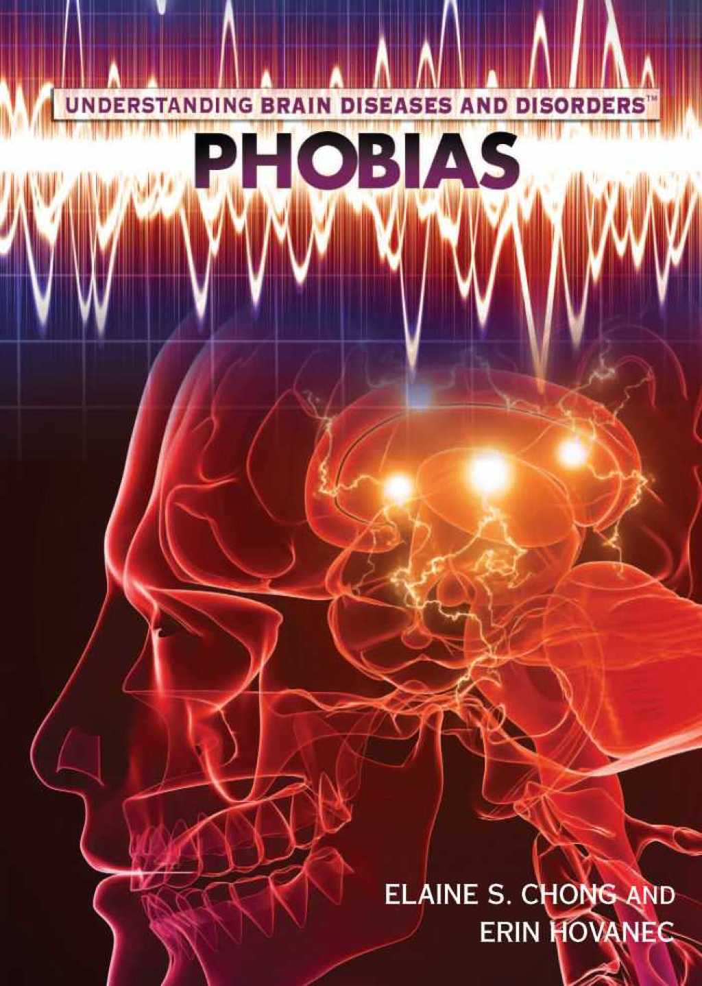 Phobias  â€“ PDF/EPUB Version Downloadable