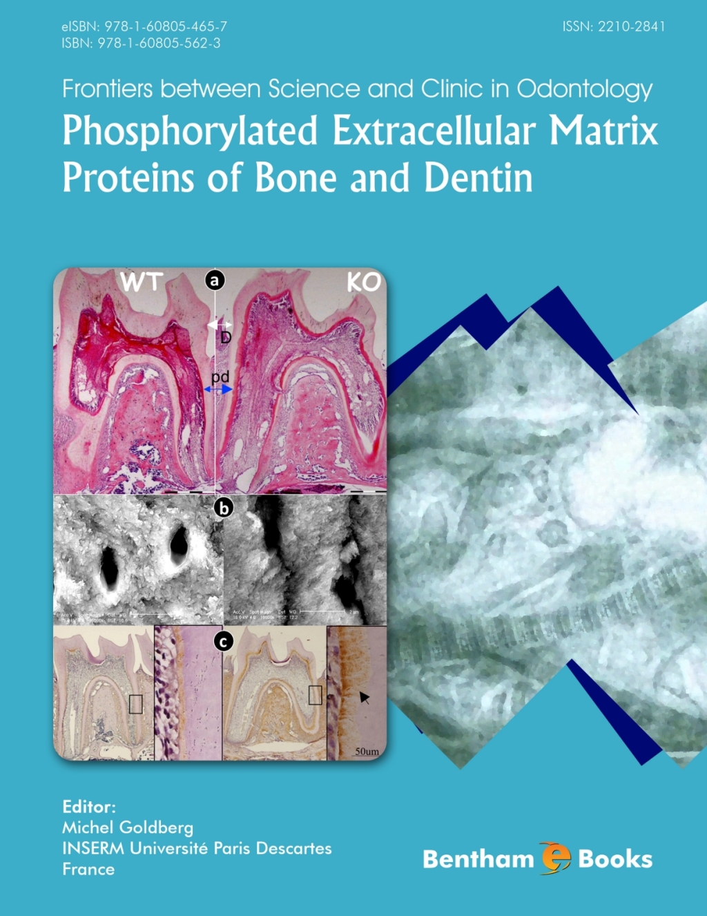 Phosphorylated Extracellular Matrix Proteins of Bone and Dentin 1st Edition â€“ PDF/EPUB Version Downloadable