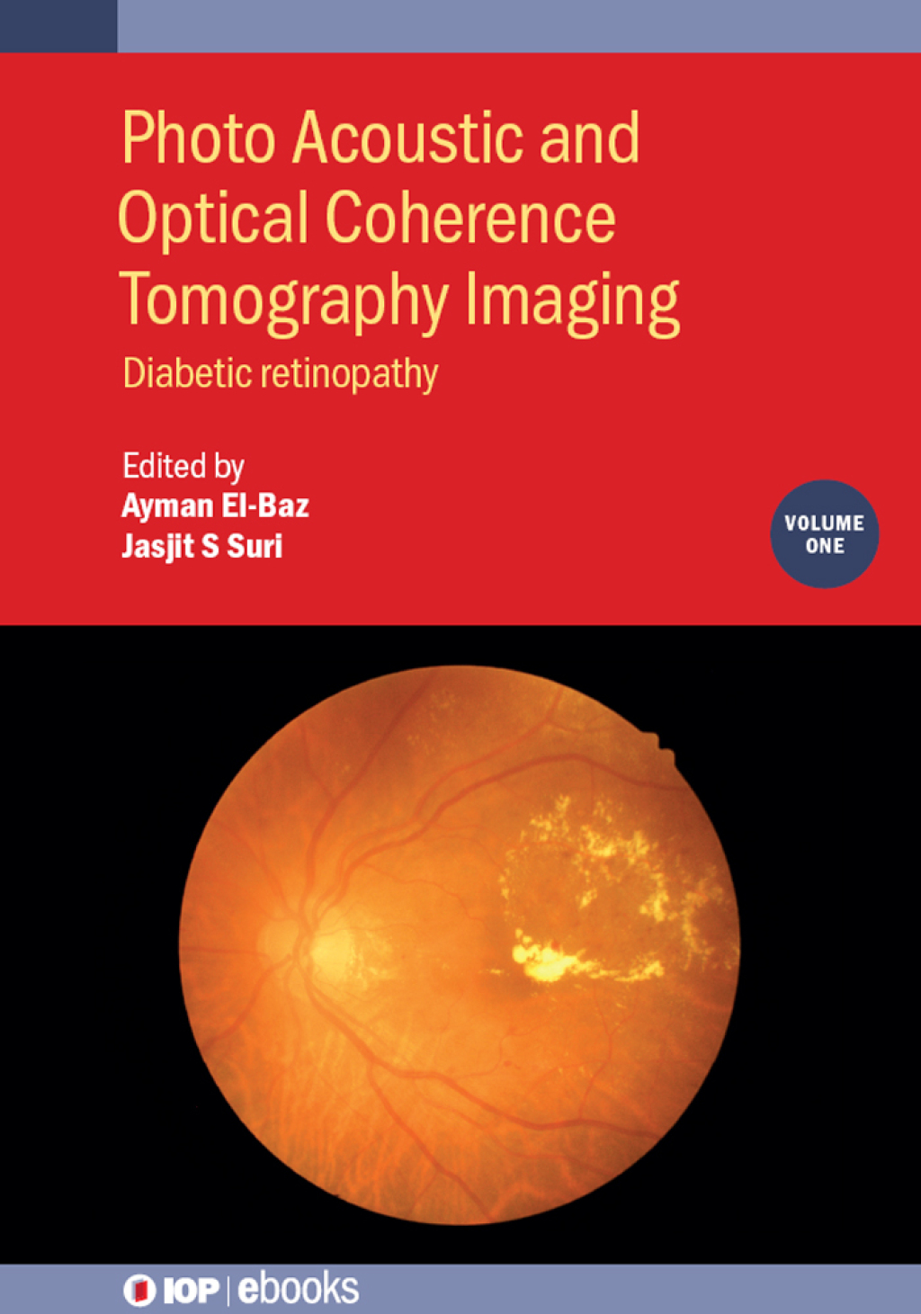 Photo Acoustic and Optical Coherence Tomography Imaging, Volume 1 Diabetic retinopathy  â€“ PDF/EPUB Version Downloadable