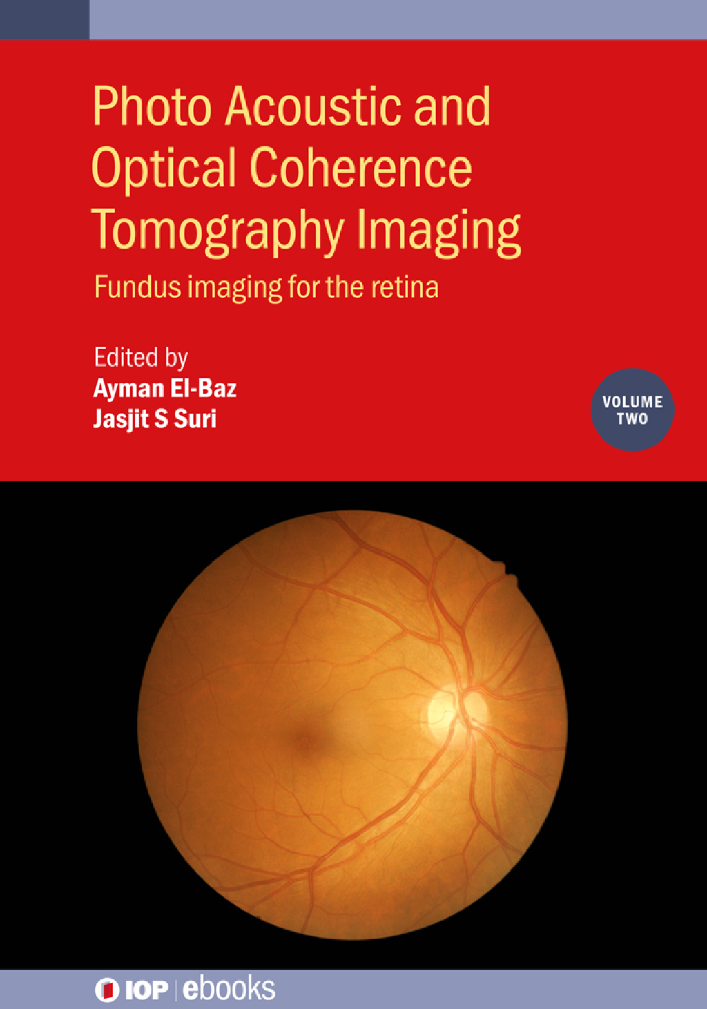 Photo Acoustic and Optical Coherence Tomography Imaging, Volume 2 Fundus imaging for the retina  â€“ PDF/EPUB Version Downloadable