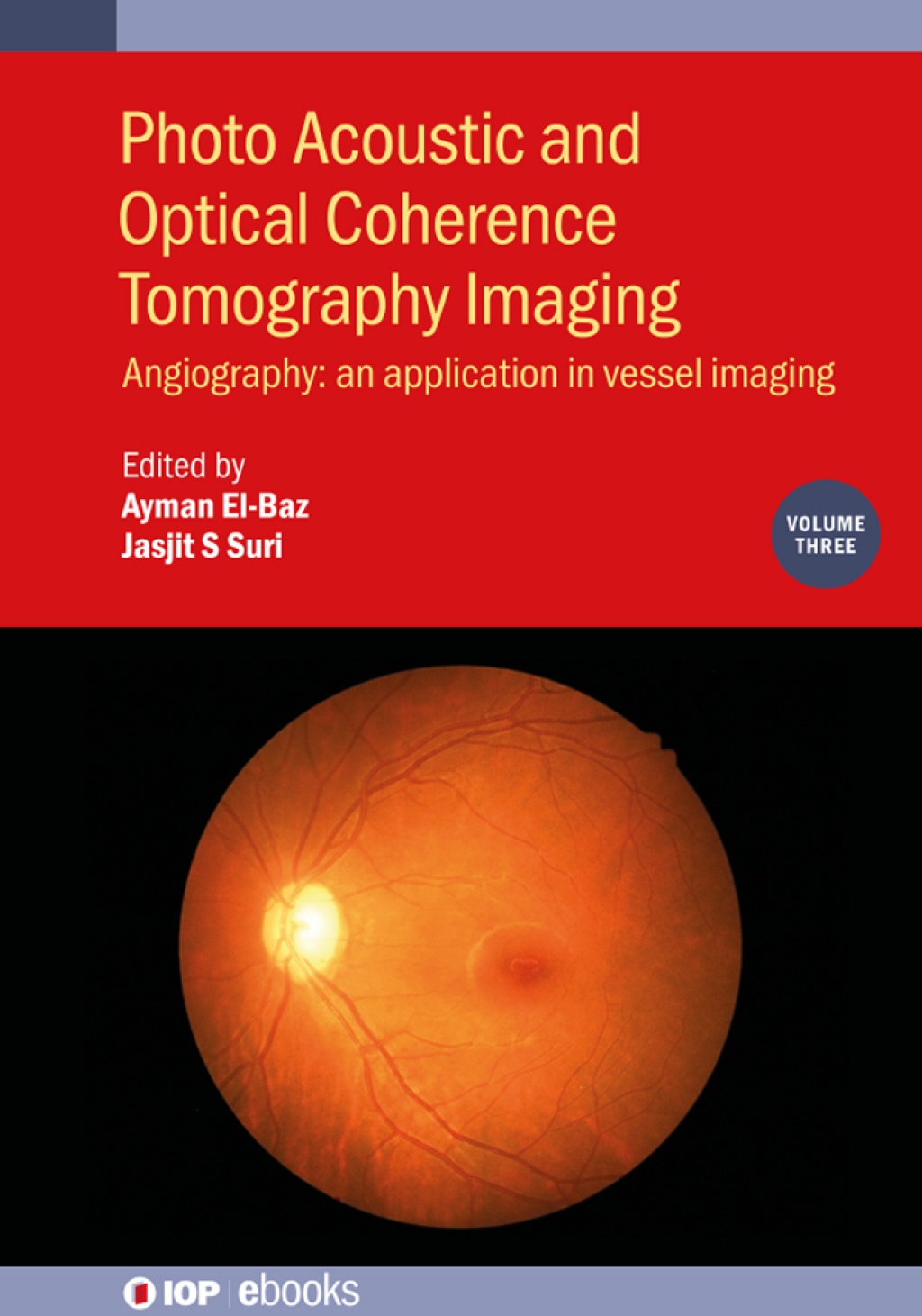 Photo Acoustic and Optical Coherence Tomography Imaging, Volume 3 Angiography: an application in vessel imaging  â€“ PDF/EPUB Version Downloadable