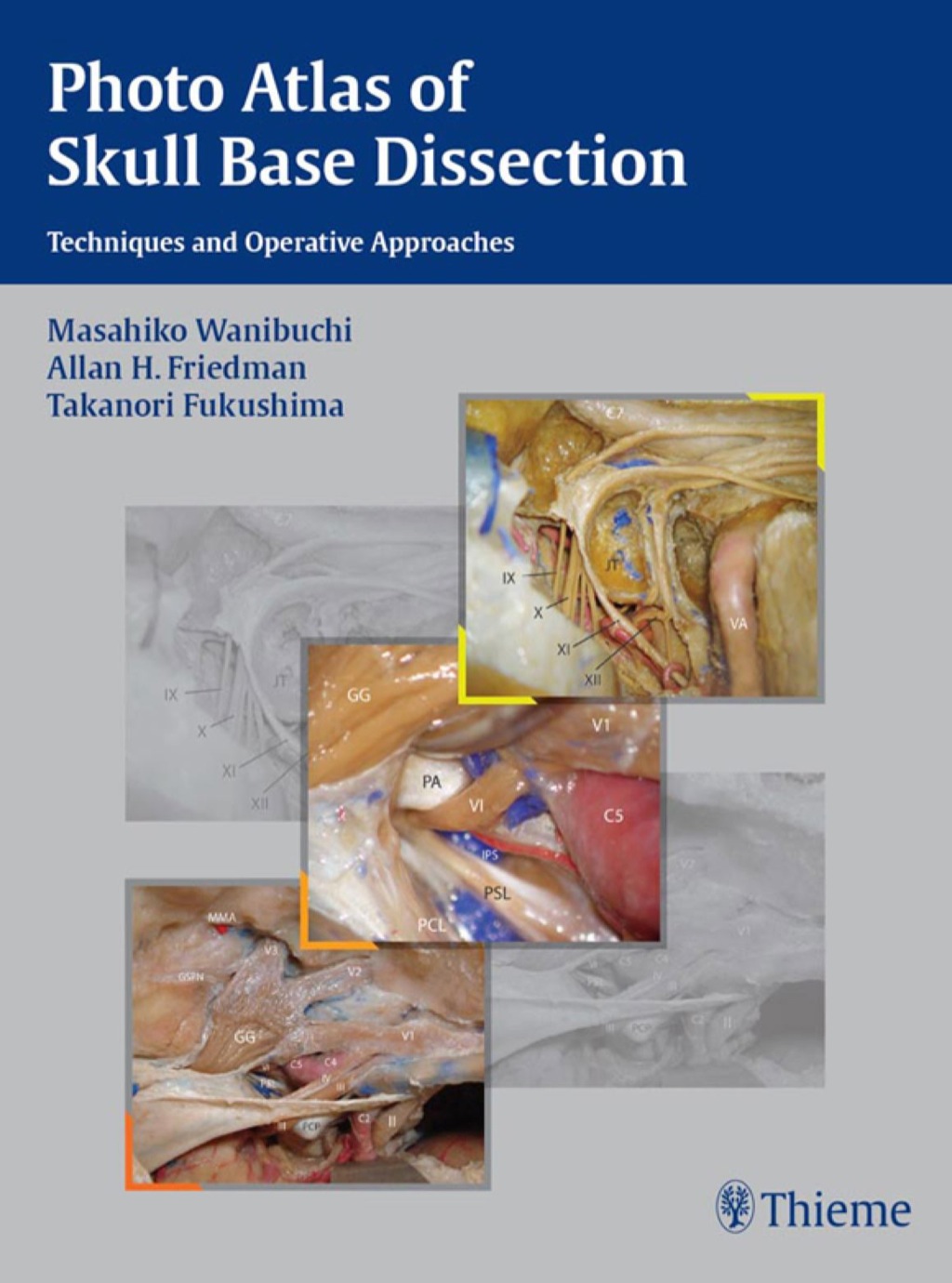 Photo Atlas of Skull Base Dissection Techniques and Operative Approaches 1st Edition â€“ PDF/EPUB Version Downloadable