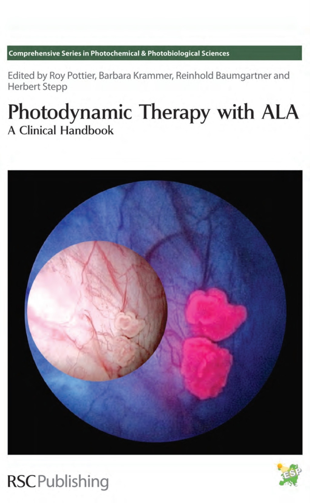 Photodynamic Therapy with ALA A Clinical Handbook 1st Edition â€“ PDF/EPUB Version Downloadable