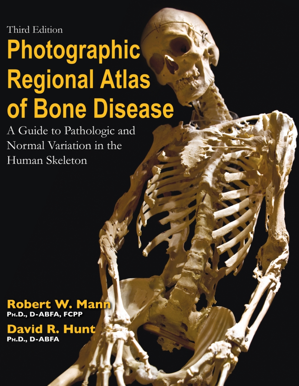 Photographic Regional Atlas of Bone Disease: A Guide to Pathologic and Normal Variation in the Human Skeleton 3rd Edition â€“ PDF/EPUB Version Downloadable