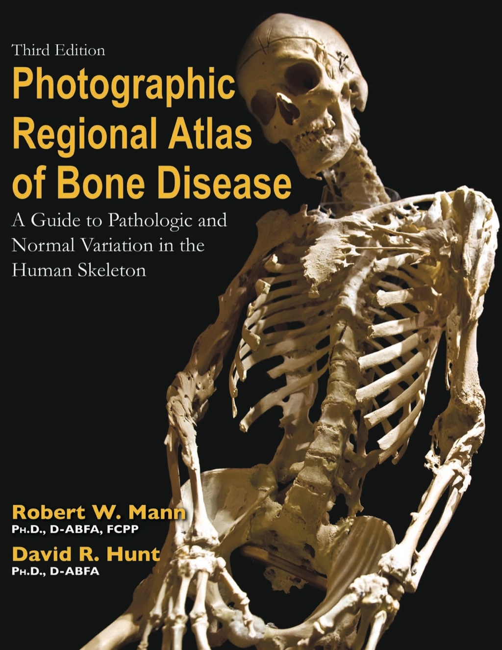 Photographic Regional Atlas of Bone Disease: "A Guide to Pathologic and Normal Variationin the Human Skeleton" 3rd Edition â€“ PDF/EPUB Version Downloadable