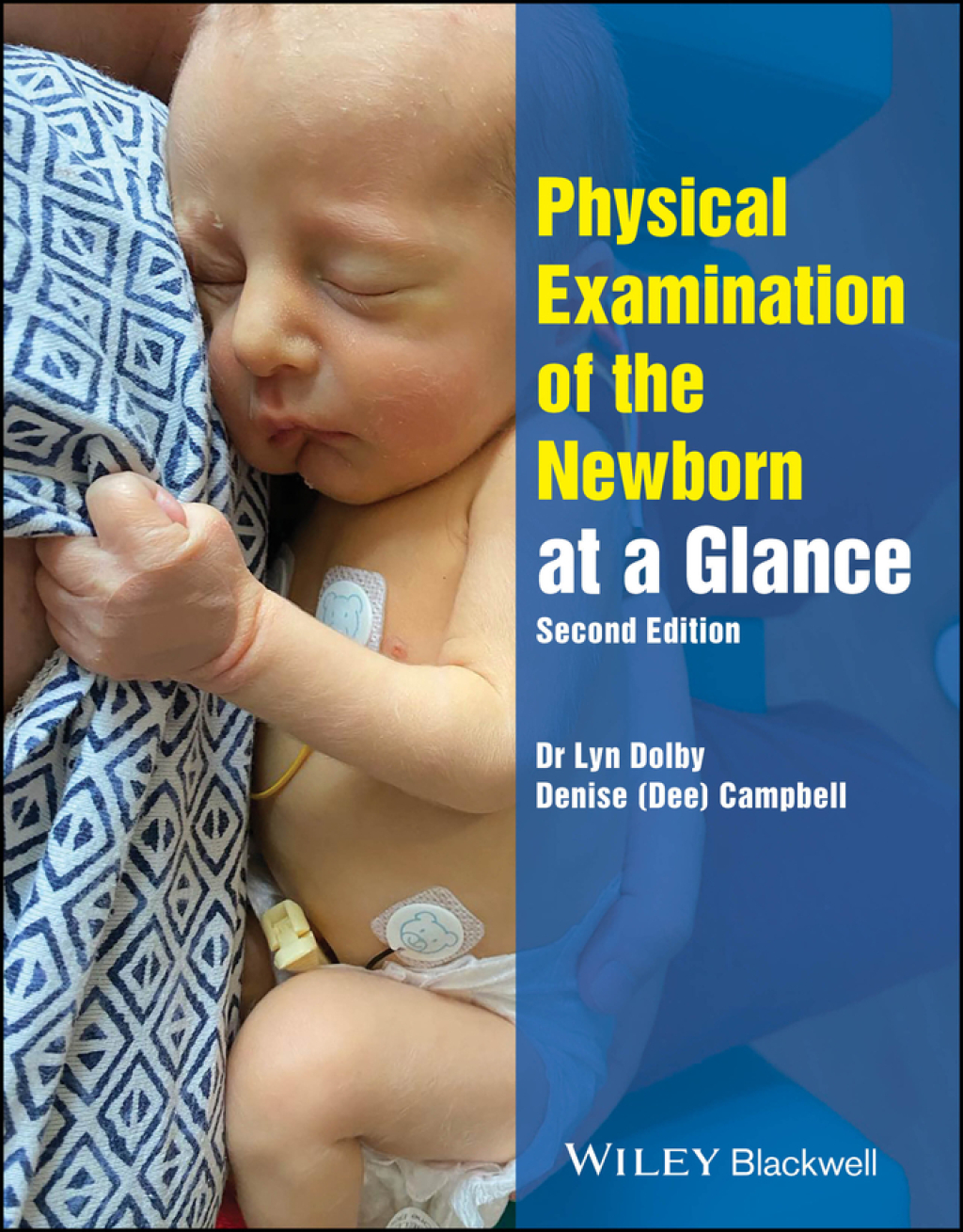 Physical Examination of the Newborn at a Glance 2nd Edition - (PDF/EPUB Version)
