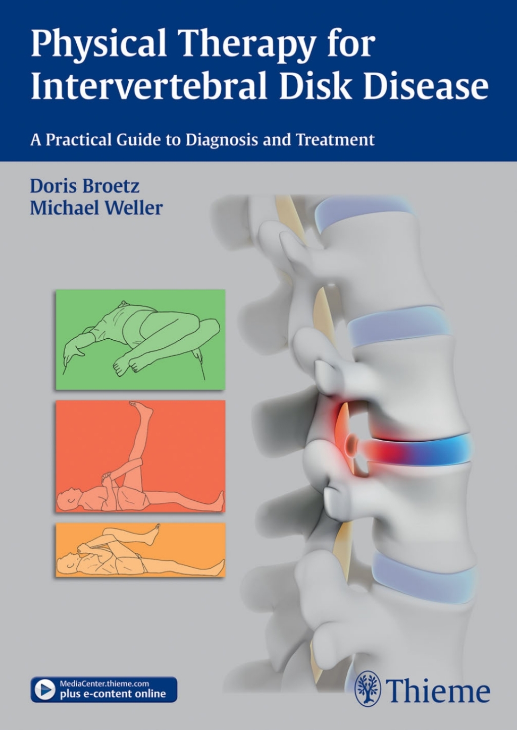 Physical Therapy for Intervertebral Disk Disease A Practical Guide to Diagnosis and Treatment 1st Edition â€“ PDF/EPUB Version Downloadable