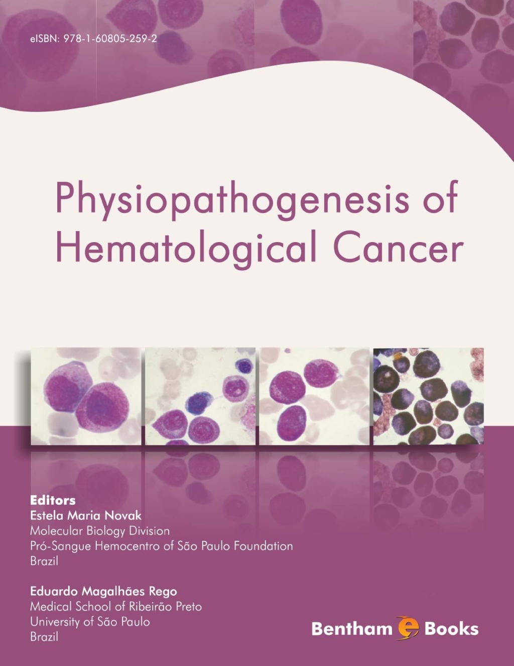 Physiopathogenesis of Hematological Cancer 1st Edition â€“ PDF/EPUB Version Downloadable
