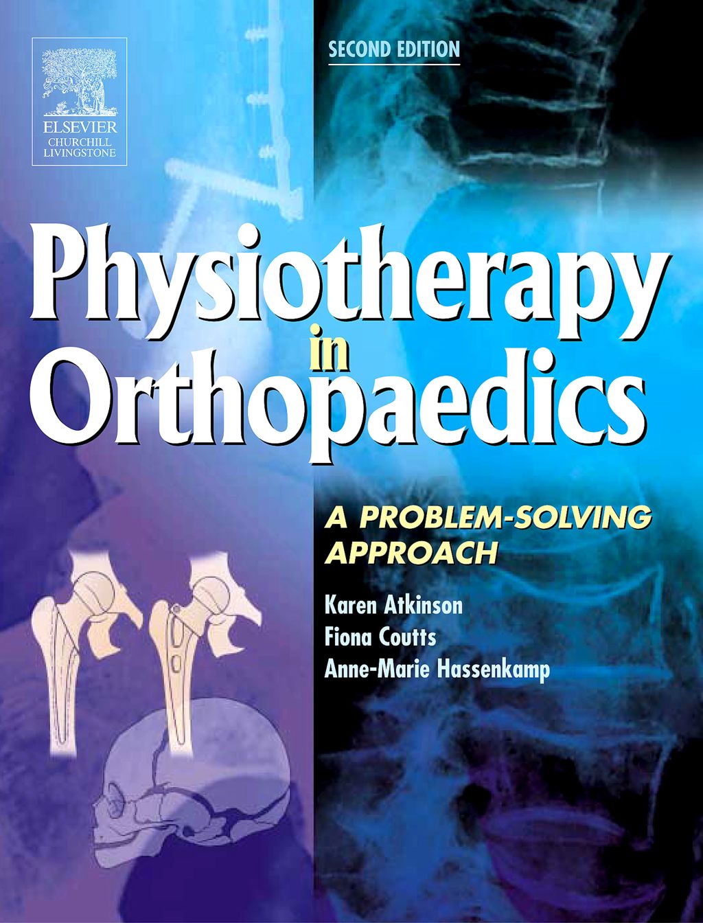 Physiotherapy in Orthopaedics 2nd Edition â€“ PDF/EPUB Version Downloadable