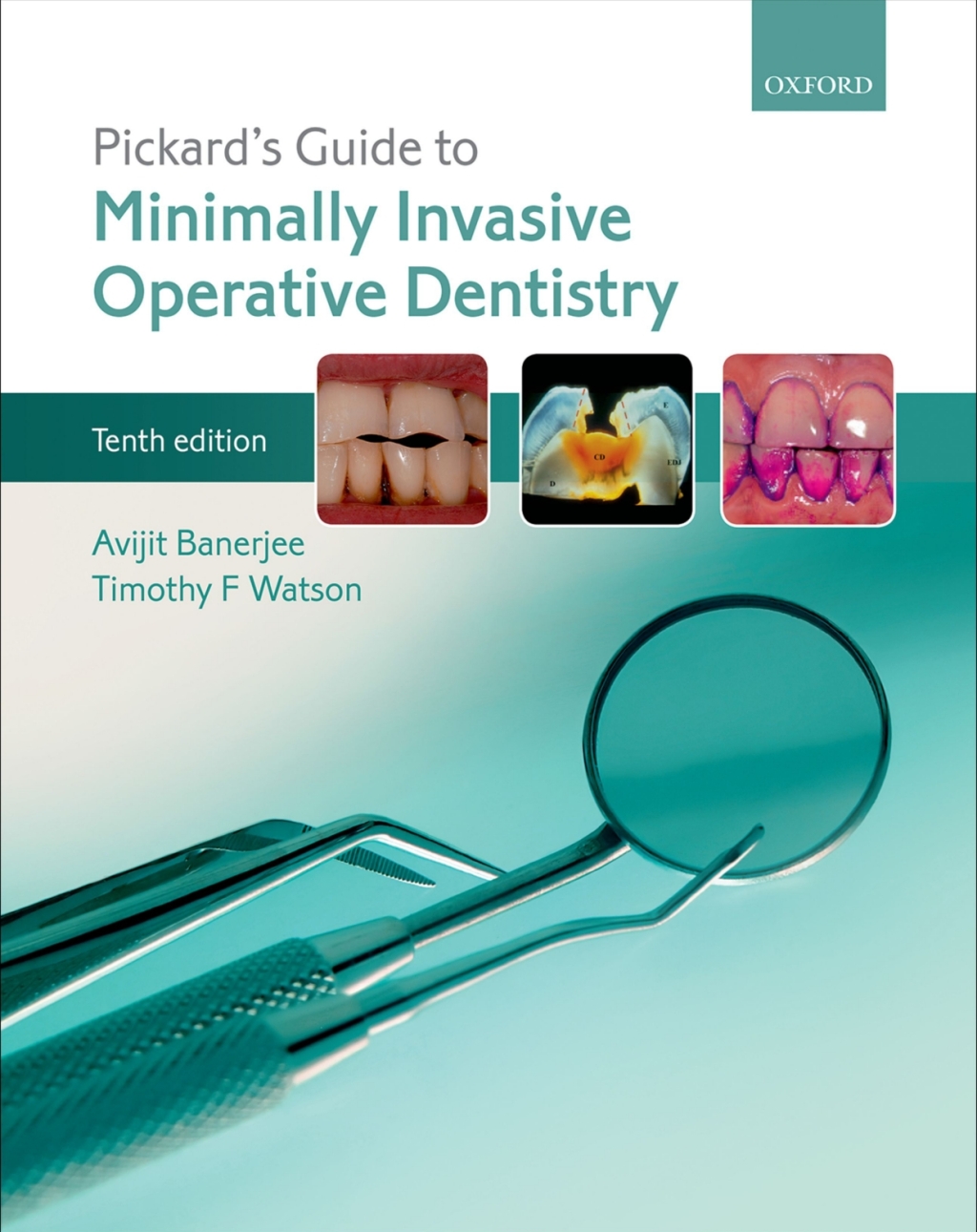 Pickard's Guide to Minimally Invasive Operative Dentistry 10th Edition â€“ PDF/EPUB Version Downloadable