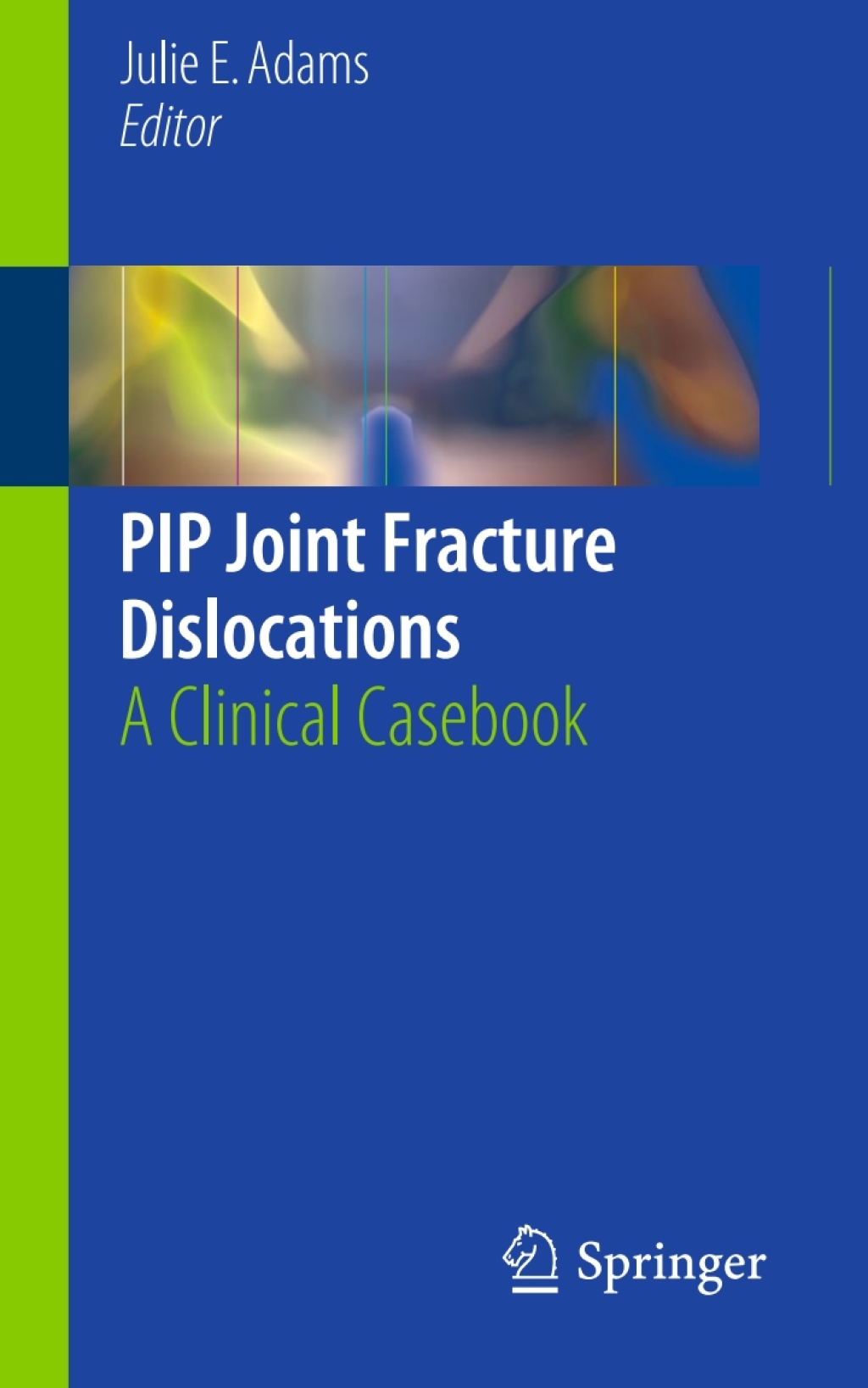 PIP Joint Fracture Dislocations A Clinical Casebook  â€“ PDF/EPUB Version Downloadable