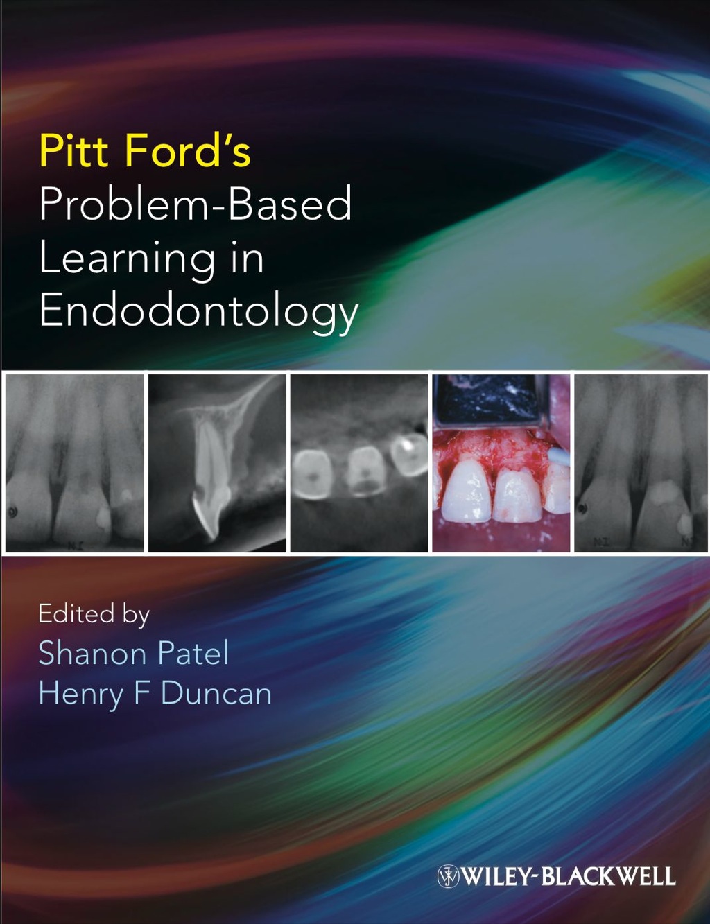 Pitt Ford's Problem-Based Learning in Endodontology 1st Edition â€“ PDF/EPUB Version Downloadable