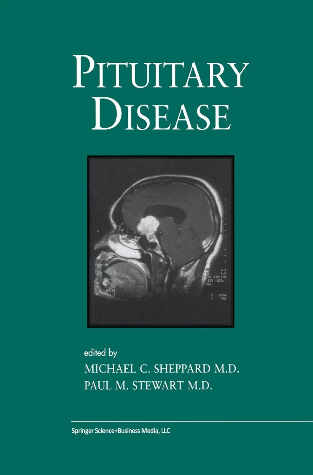 Pituitary Disease 1st Edition â€“ PDF/EPUB Version Downloadable