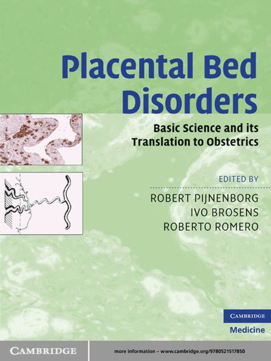 Placental Bed Disorders Basic Science and its Translation to Obstetrics 1st Edition â€“ PDF/EPUB Version Downloadable