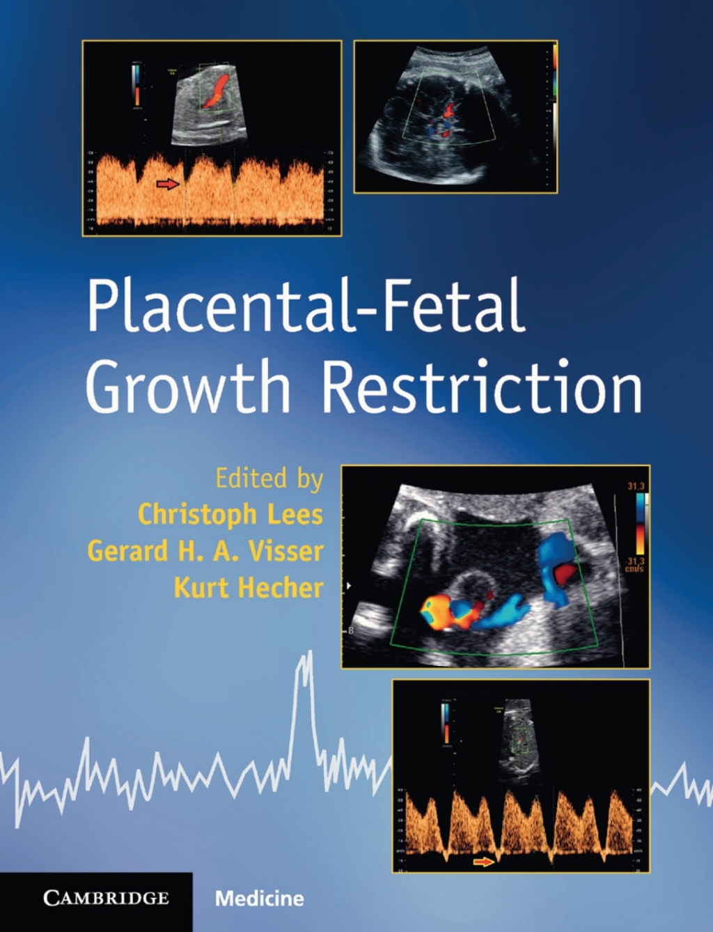 Placental-Fetal Growth Restriction  â€“ PDF/EPUB Version Downloadable