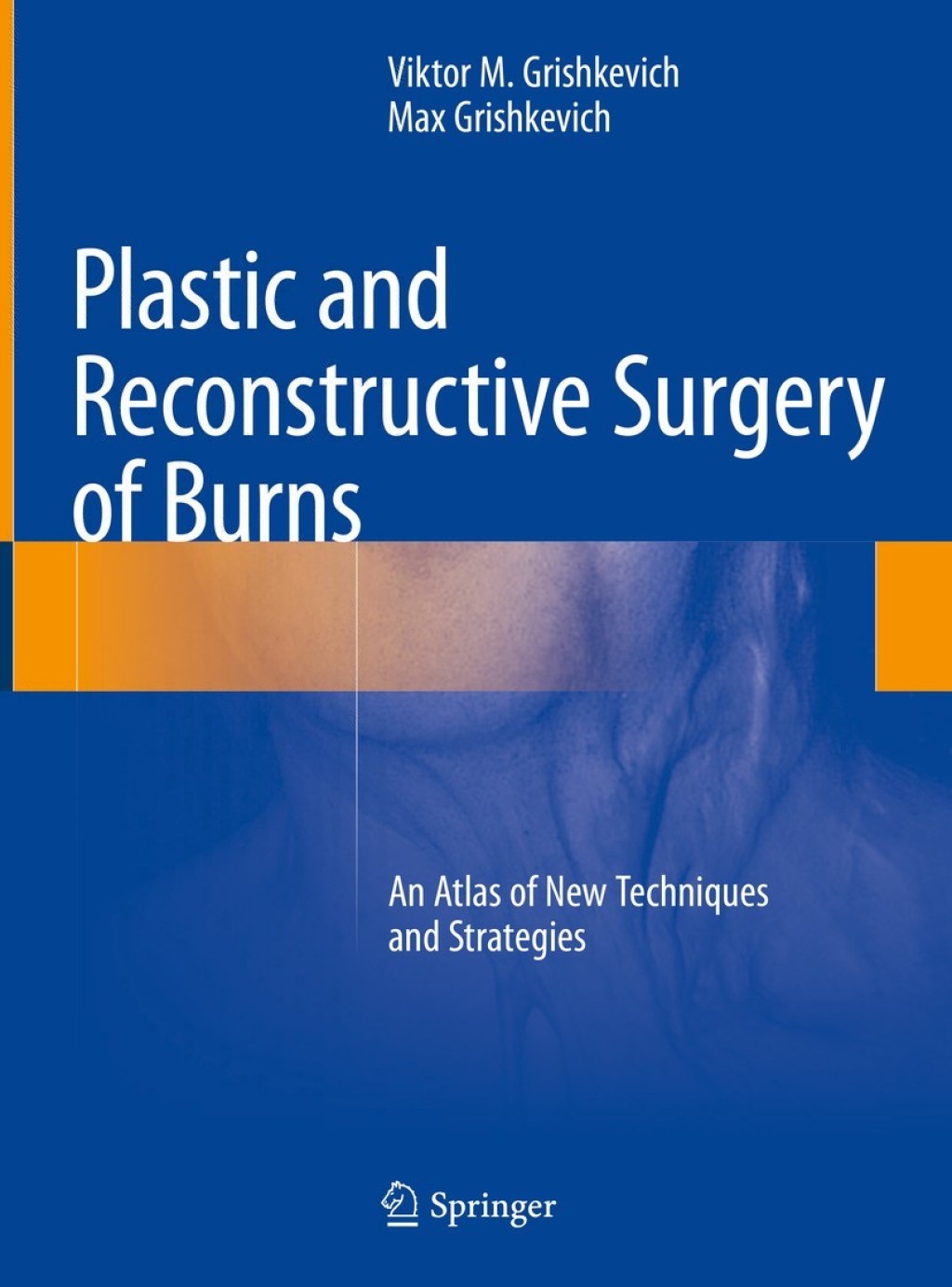 Plastic and Reconstructive Surgery of Burns An Atlas of New Techniques and Strategies  â€“ PDF/EPUB Version Downloadable