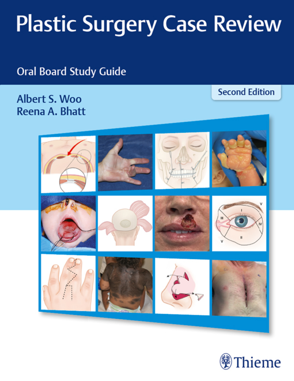 Plastic Surgery Case Review Oral Board Study Guide 2nd Edition â€“ PDF/EPUB Version Downloadable