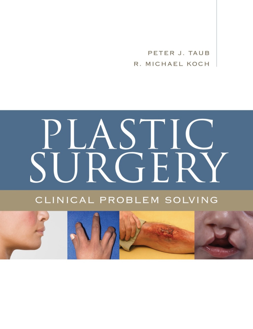 Plastic Surgery: Clinical Problem Solving 1st Edition â€“ PDF/EPUB Version Downloadable