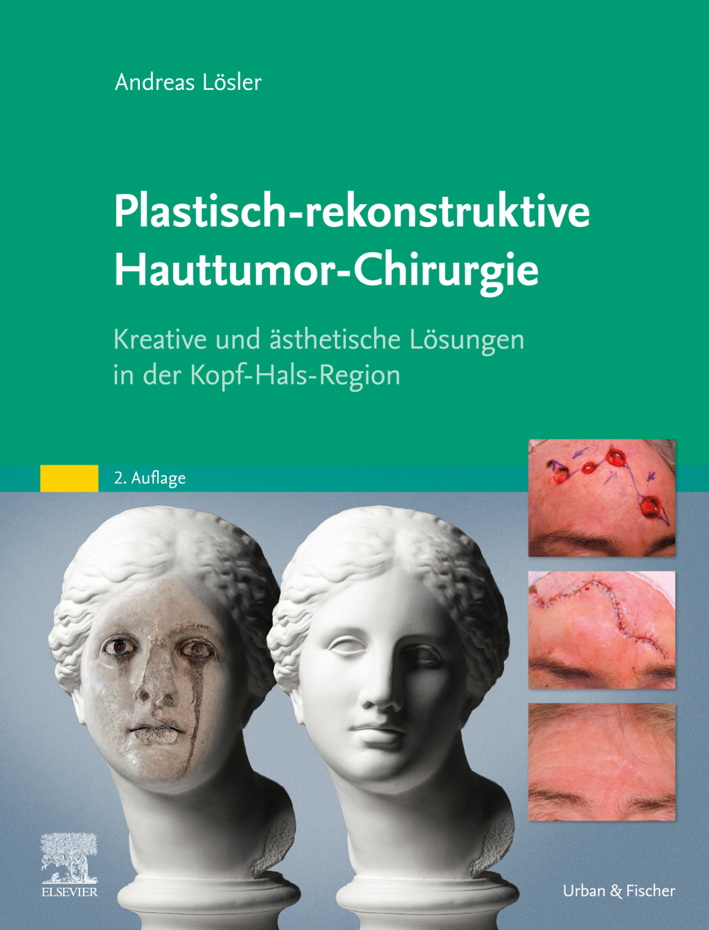 Plastisch-rekonstruktive Hauttumor-Chirurgie Kreative und Ã¤sthetische LÃ¶sungen in der Kopf-Hals-Region 2nd Edition â€“ PDF/EPUB Version Downloadable