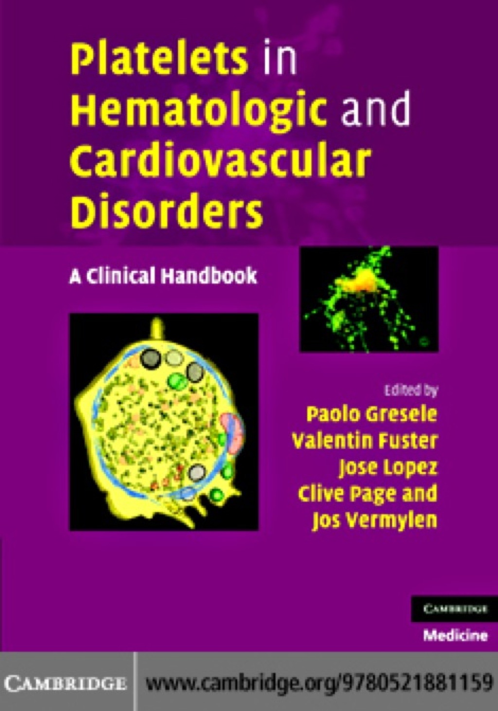 Platelets in Hematologic and Cardiovascular Disorders A Clinical Handbook 1st Edition â€“ PDF/EPUB Version Downloadable