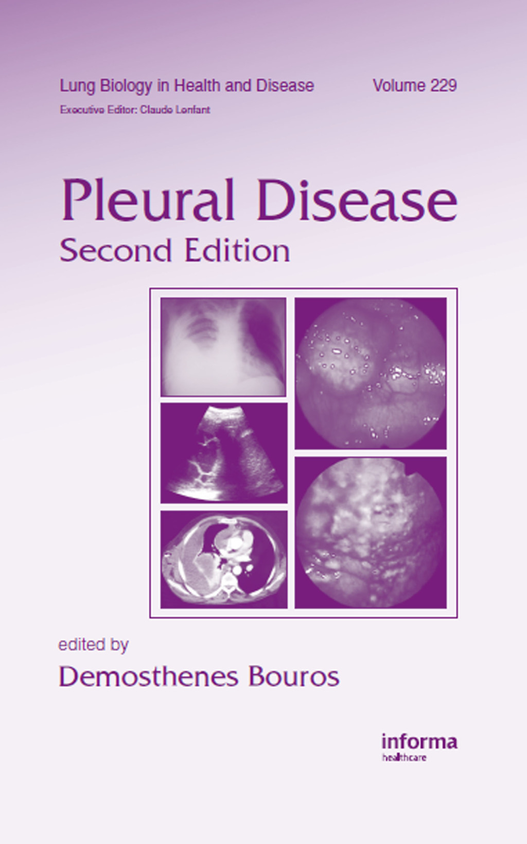 Pleural Disease 2nd Edition â€“ PDF/EPUB Version Downloadable