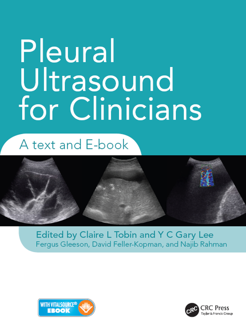 Pleural Ultrasound for Clinicians A Text and E-book 1st Edition â€“ PDF/EPUB Version Downloadable