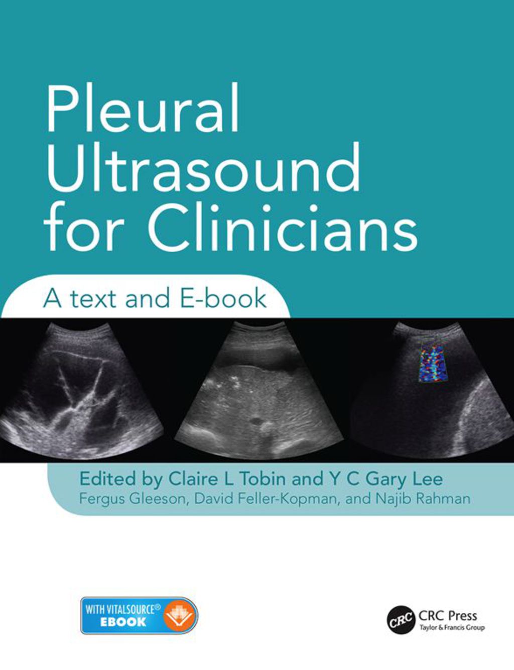 Pleural Ultrasound for Clinicians A Text and E-book 1st Edition â€“ PDF/EPUB Version Downloadable
