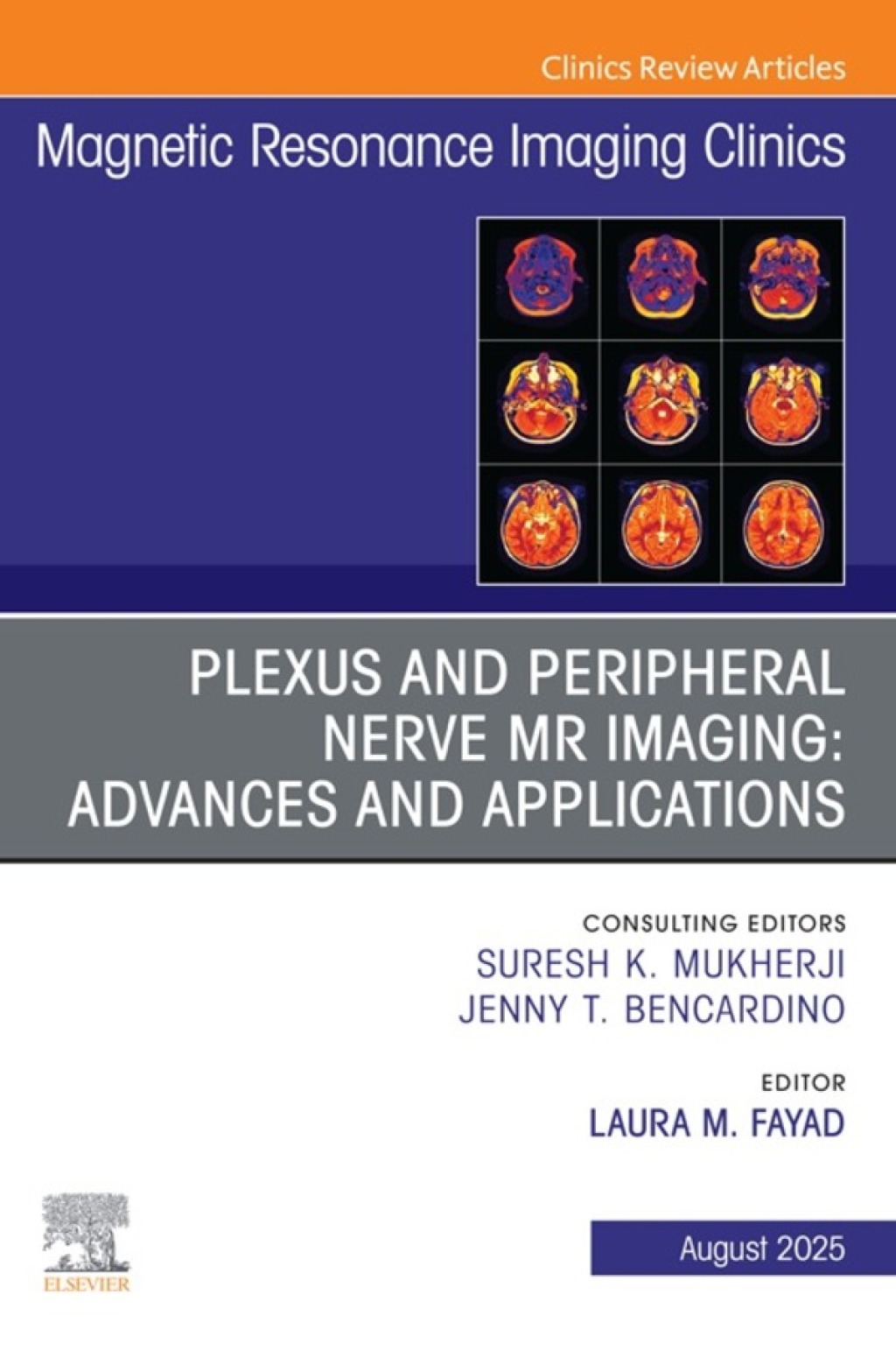 Plexus and Peripheral Nerve MR Imaging: Advances and Applications, An Issue of Magnetic Resonance Imaging Clinics of North America  â€“ PDF/EPUB Version Downloadable