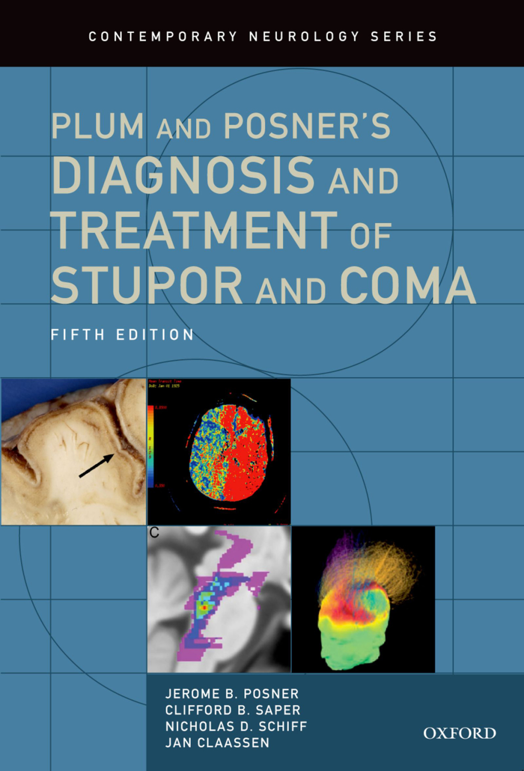 Plum and Posner's Diagnosis and Treatment of Stupor and Coma 5th Edition â€“ PDF/EPUB Version Downloadable