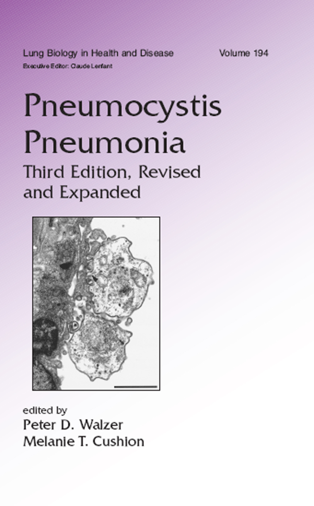 Pneumocystis Pneumonia 3rd Edition â€“ PDF/EPUB Version Downloadable