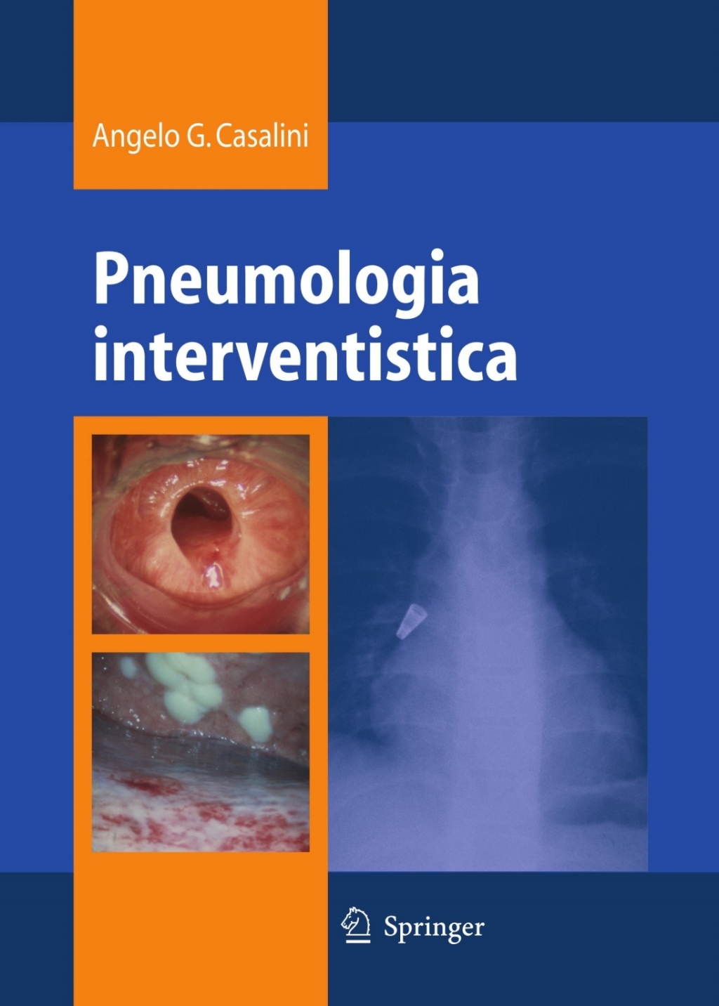 Pneumologia interventistica  â€“ PDF/EPUB Version Downloadable