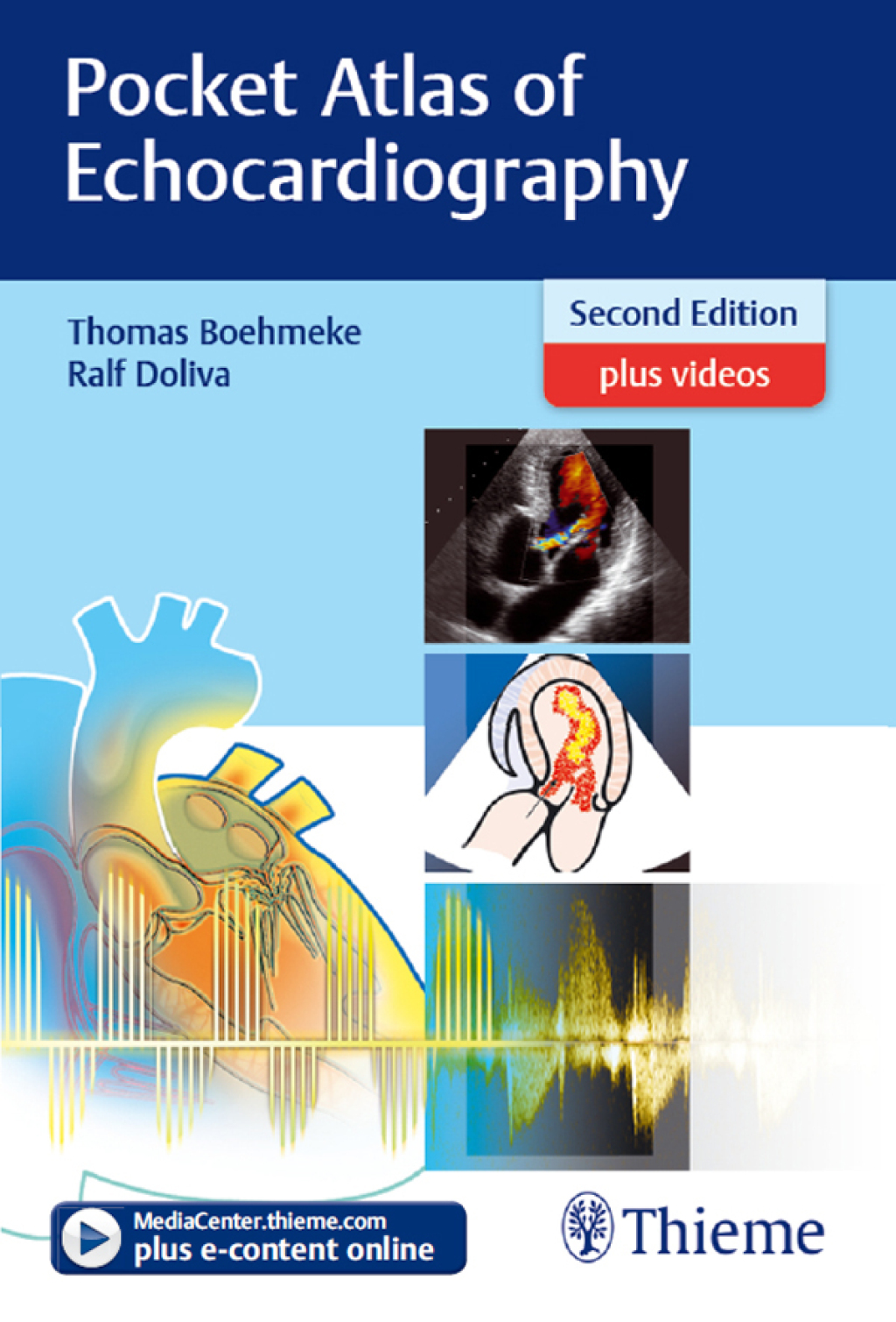 Pocket Atlas of Echocardiography 2nd Edition â€“ PDF/EPUB Version Downloadable