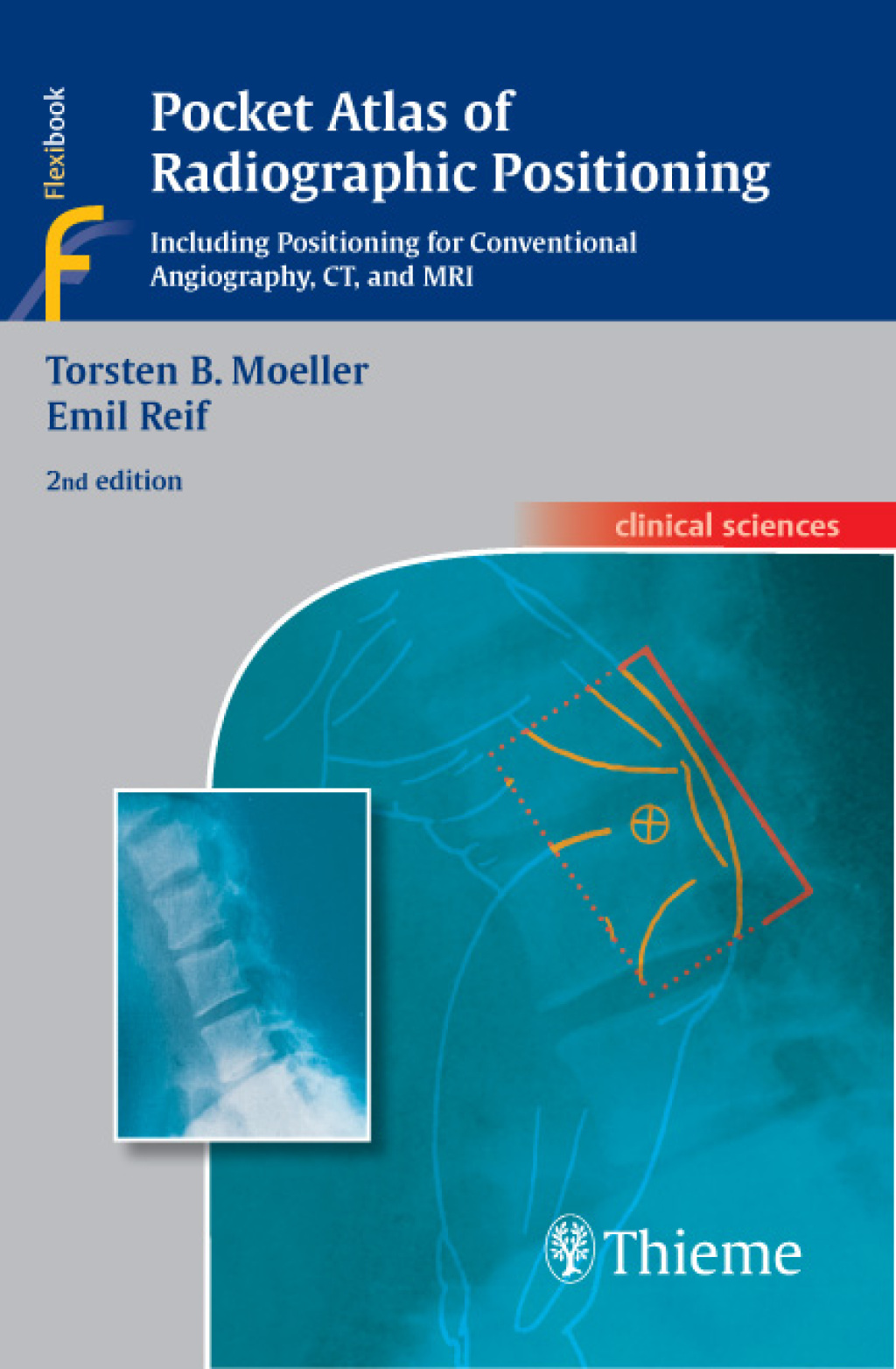 Pocket Atlas of Radiographic Positioning Including Positioning for Conventional Angiography, CT, and MRI 2nd Edition â€“ PDF/EPUB Version Downloadable