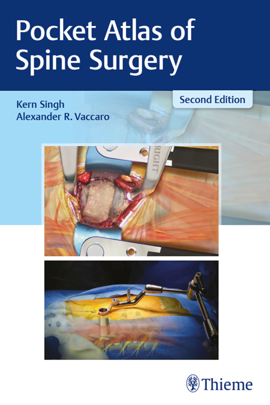 Pocket Atlas of Spine Surgery 2nd Edition â€“ PDF/EPUB Version Downloadable