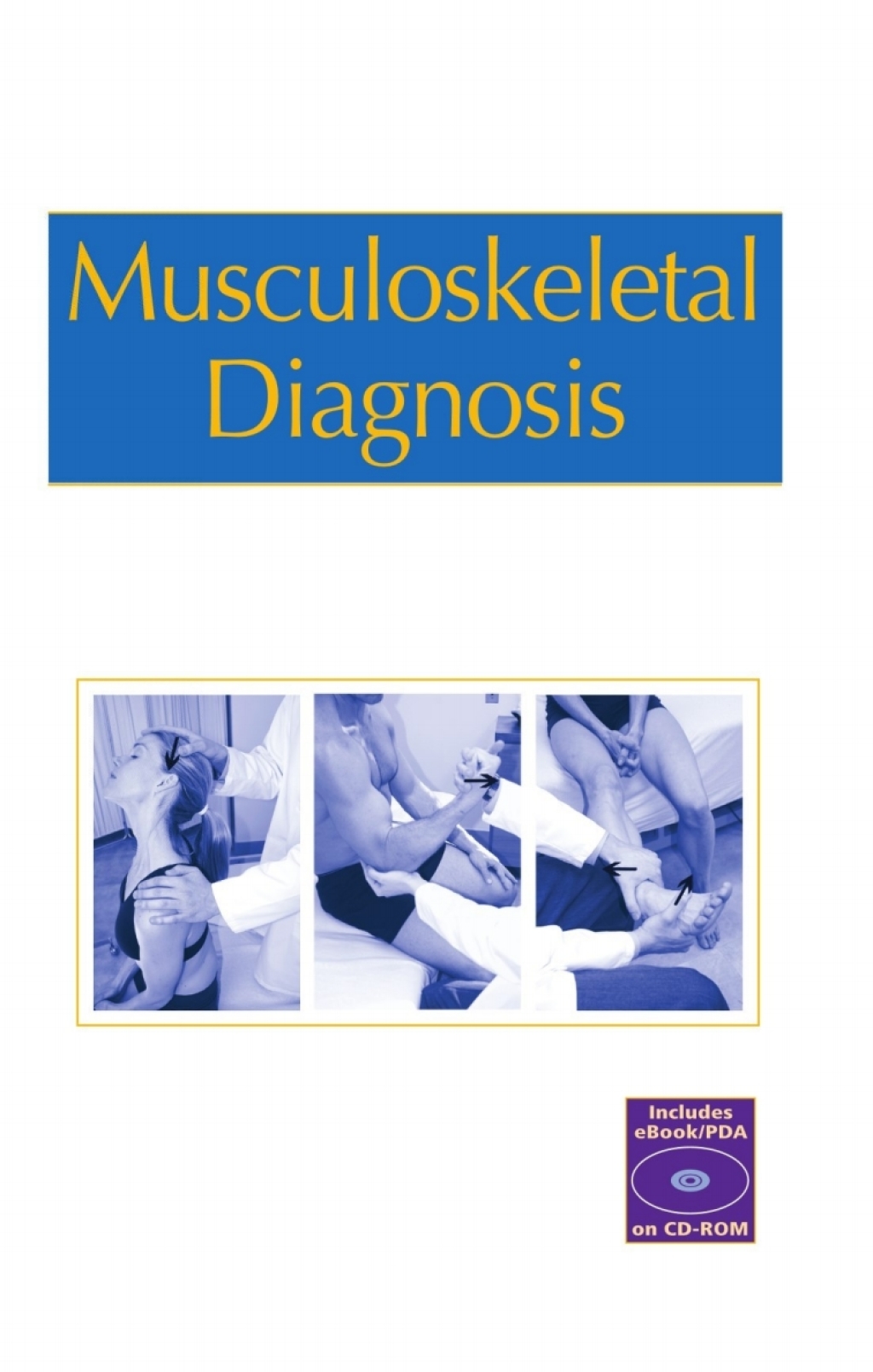 Pocket Guide to Musculoskeletal Diagnosis  â€“ PDF/EPUB Version Downloadable