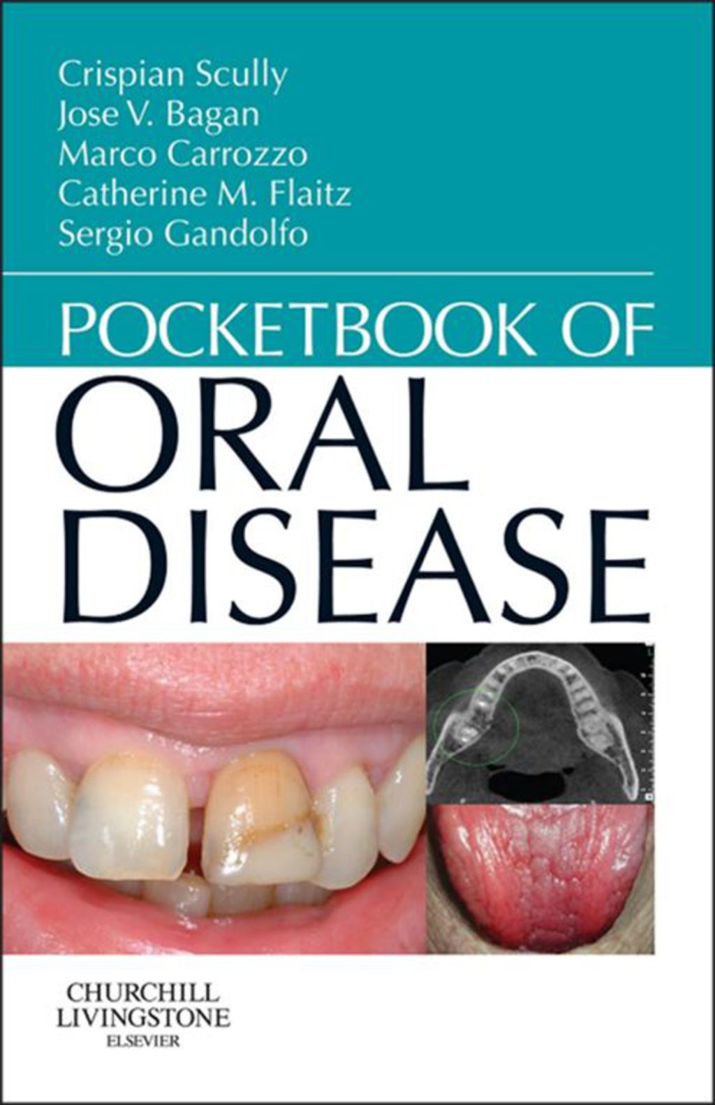 Pocketbook of Oral Disease 1st Edition â€“ PDF/EPUB Version Downloadable