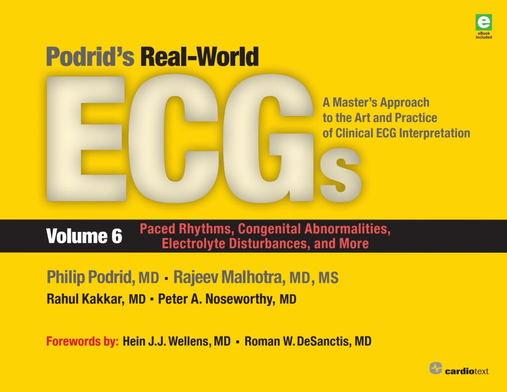 Podrid's Real-World ECGs: Volume 6, Paced Rhythms, Congenital Abnormalities, Electrolyte Disturbances, and More A Master's Approach to the Art and Practice of Clinical ECG Interpretation 1st Edition â€“ PDF/EPUB Version Downloadable