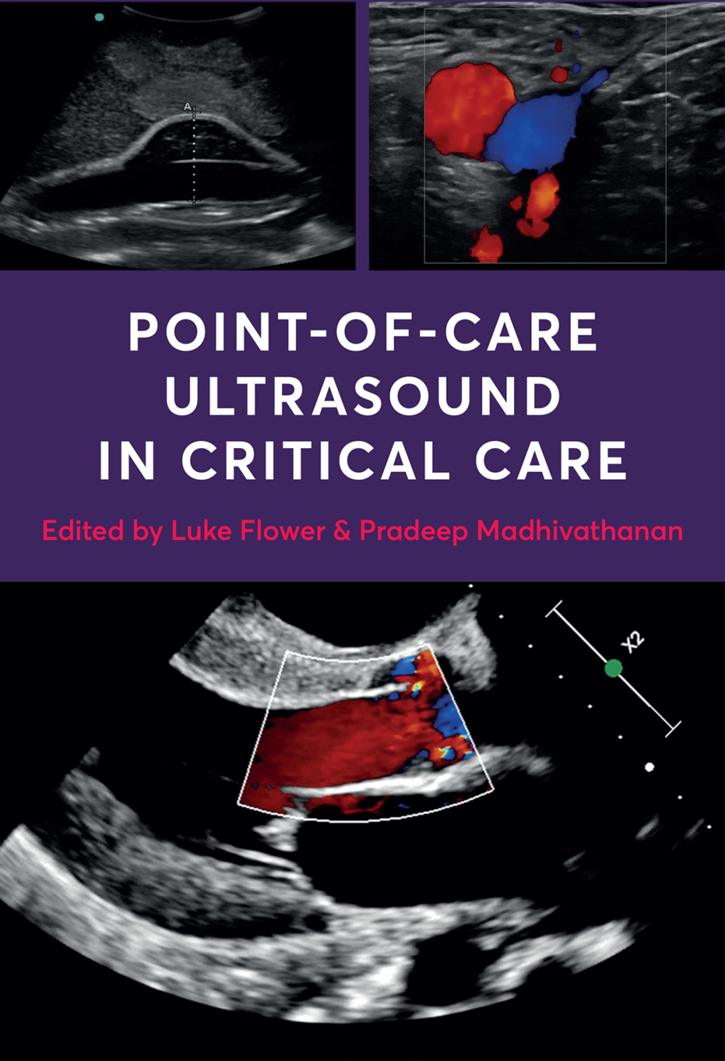 Point-of-Care Ultrasound in Critical Care  â€“ PDF/EPUB Version Downloadable