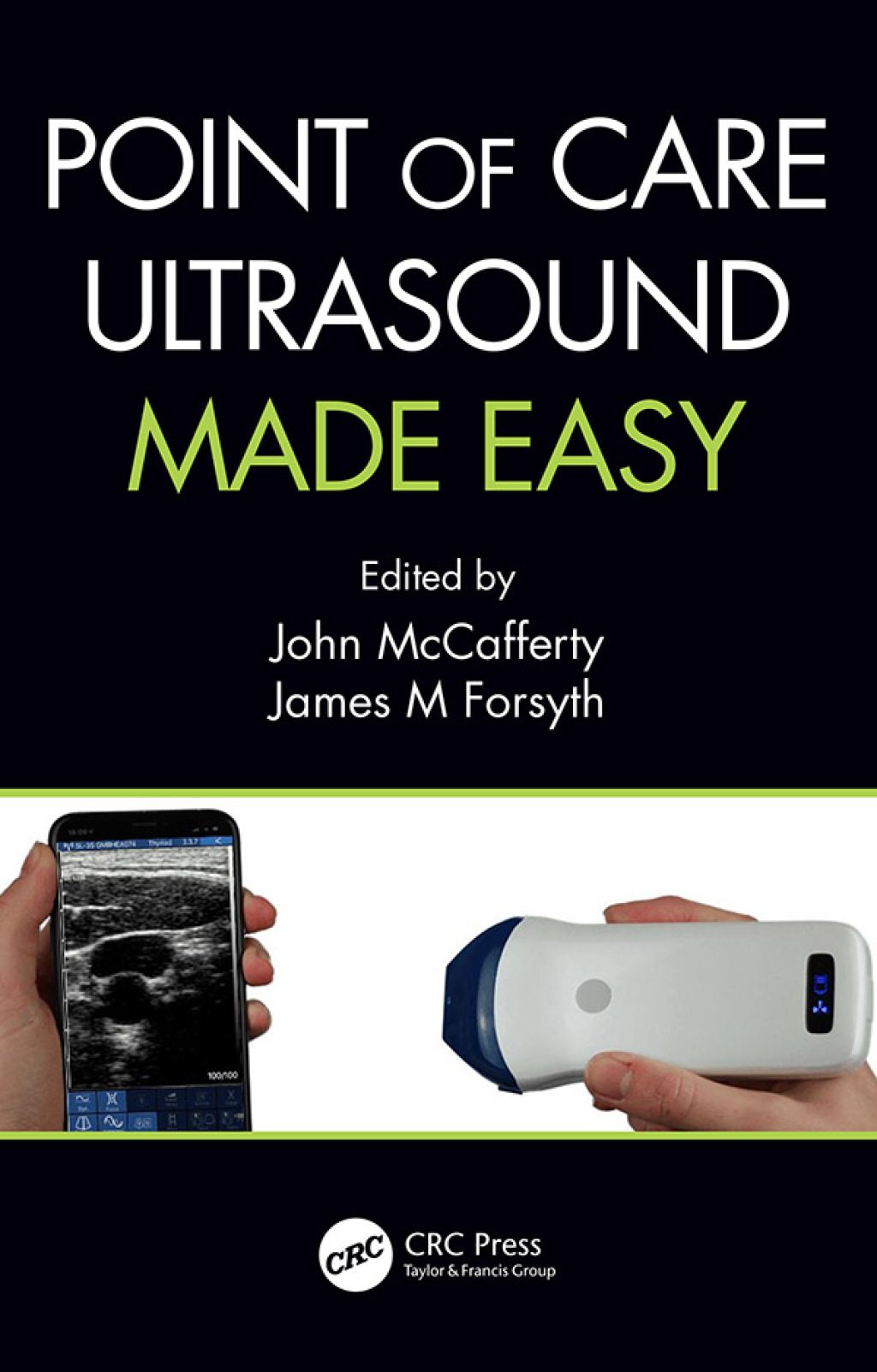 Point of Care Ultrasound Made Easy 1st Edition - (PDF/EPUB Version)