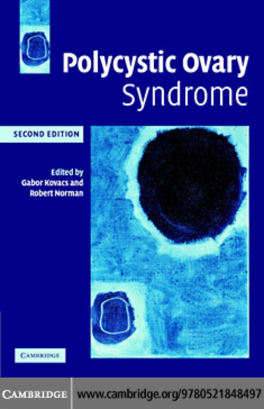 Polycystic Ovary Syndrome 2nd Edition â€“ PDF/EPUB Version Downloadable