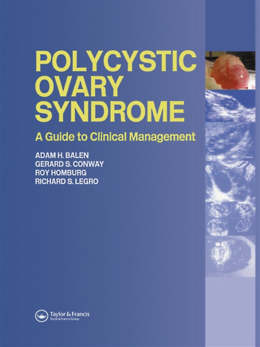 Polycystic Ovary Syndrome A Guide to Clinical Management 1st Edition â€“ PDF/EPUB Version Downloadable